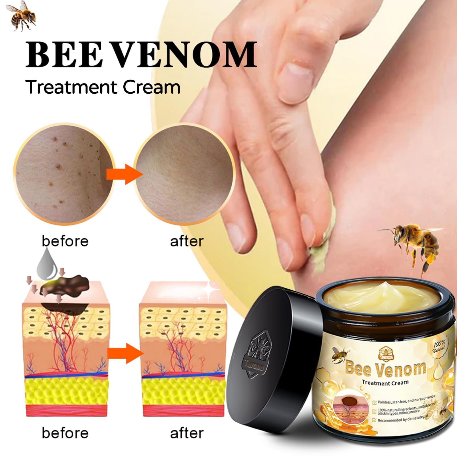 Bee Venom Wart Care Cream thumbnail 3 (Rose)